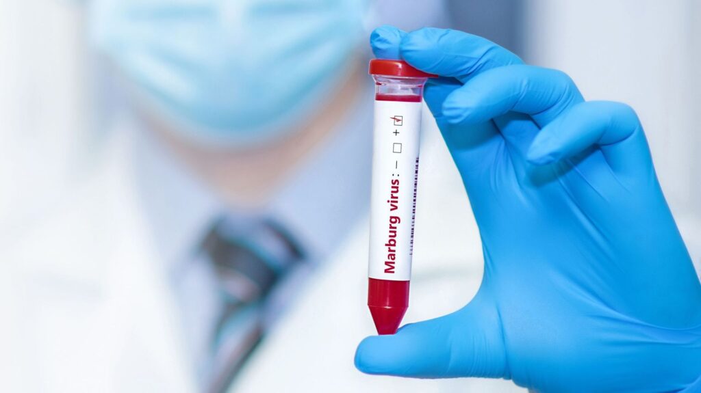 Virus de Marburg : 7 cas suspects notifiés